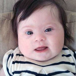 Mom’s Plea On How To Talk About Kids With Down Syndrome Goes Viral